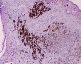 国产多毛阴唇视频,真实案例与专业解读